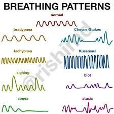 ¿Que es la respiración apneustica